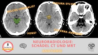 Anatomie im CT und MRT Schädel [upl. by Eibba500]