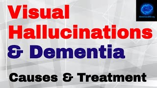 Visual Hallucinations amp Dementia Causes amp What To Do [upl. by Daryn964]