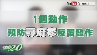 【暖醫在線】蕁麻疹不癢了就沒事？做到「這件事」才能避免反覆發作 [upl. by Ezitram]