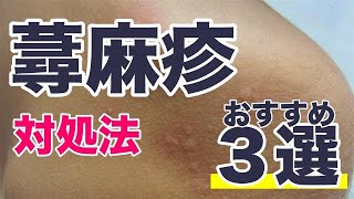 蕁麻疹の対処法のおすすめ３選 [upl. by Kind93]