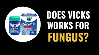 Does Vicks Vaporub work for fungus nails [upl. by Emirac635]