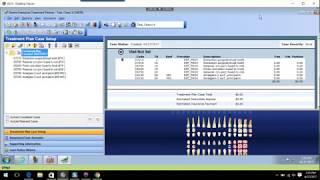 Dentrix Treatment Planner Module [upl. by Ainegue948]