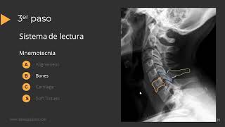 Radiografía de Columna Paso a Paso [upl. by Battiste]