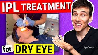 Lumenis IPL Dry Eye Treatment Doctor Becomes the Patient [upl. by Saxe896]