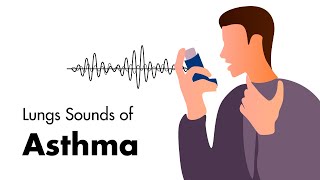 What are symptoms of asthma in children Dr Cajetan Tellis [upl. by Anila504]