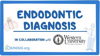 Endodontic Diagnosis in Collaboration w Western University [upl. by Gearhart]