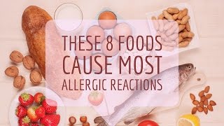 Food Allergy Causes Signs and Symptoms Diagnosis and Treatment [upl. by Gnidleif]