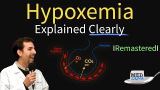 Understanding Hypoxia in High Altitude Environments [upl. by Adeuga]