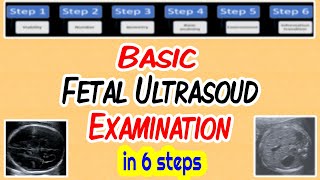 Basic Fetal Ultrasound Examination [upl. by Elok]