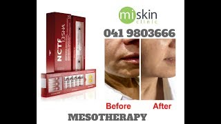 Filorga NCTF Mesotherapy [upl. by Lucille456]