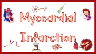 Myocardial InfarctionHeart Attack Causes Pathogenesis Signs amp Symptoms Diagnosis amp Treatment [upl. by Nedlog]