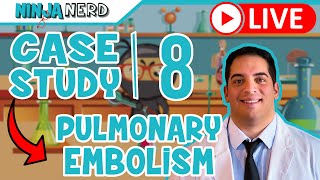 Case Study 8 Pulmonary Embolism [upl. by Korwin768]