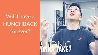 How long does it take to fix hunchback posture [upl. by Aelrac]