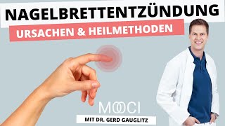 Was tun bei Nagelbettentzündung  10 Fragen an PD Dr med Gerd Gauglitz  MOOCI [upl. by Zerdna]