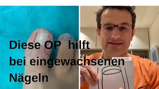 Hilfe bei eingewachsenen Zehenägeln [upl. by Aihsoek]