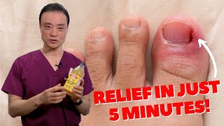 6 HOME REMEDIES To Treat A PAINFUL Ingrown Nail  Dr Kim [upl. by Sande210]