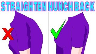 The 4 minute solution to correct hunchback kyphosis [upl. by Alleb]