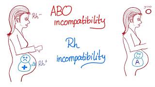 ABO incompatibility vs Rh incompatibility [upl. by Lamrert]