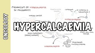 Hypercalcemia in malignancy  causes pathophysiology symptoms treatment [upl. by Prisca]