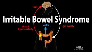 Irritable Bowel Syndrome Pathophysiology Symptoms Causes Diagnosis and Treatment Animation [upl. by Anailuig]