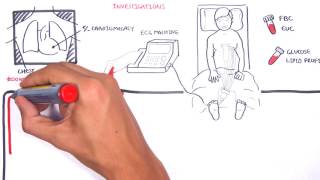 Acute Coronary Syndrome DETAILED Overview MI STEMI NSTEMI [upl. by Jevon]