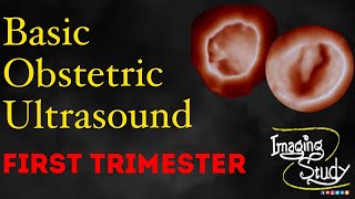 Basic Obstetric Ultrasound First Trimester Pregnancy [upl. by Tilagram]