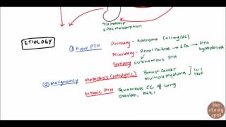 Hypercalcemia for USMLE Step 1 and USMLE Step 2 [upl. by Annaitat]