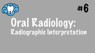 Oral Radiology  Radiographic Interpretation  INBDE ADAT [upl. by Odnalref]