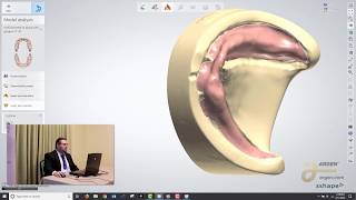 Digital Dentures A Crash Course on How to Design using 3Shape  Logan Woomer [upl. by Nauqit]