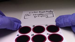 Latex Agglutination FOR Streptococcus Grouping [upl. by Inaluahek]