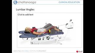 Angulation in spinal distraction [upl. by Kra205]