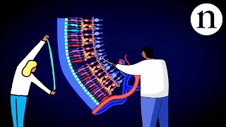 Retinal repair Bringing stem cells into focus [upl. by Arikal663]