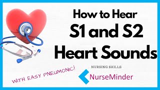 How to Hear S1 and S2 Heart Sounds [upl. by Noelc]