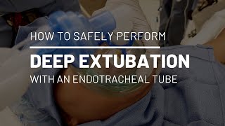 HOW TO INTUBATE INTUBATION PROCEDURE amp TECHNIQUE [upl. by Armbruster3]