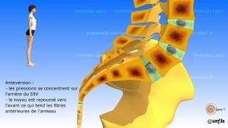 Vidéo sonorisée Placement du bassin  charnière lombosacrée [upl. by Adelpho]