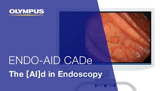 ENDOAID CADe The AId in Endoscopy  EVIS X1  Gastroenterology  OLYMPUS [upl. by Ahsilad]