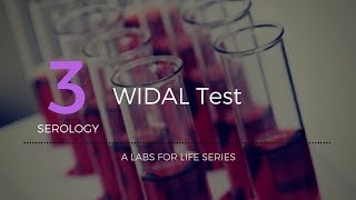 Widal test [upl. by Ateuqirne]