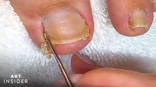 How Toenails Are Professionally Cleaned [upl. by Wakefield]