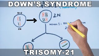 Downs Syndrome [upl. by Eiduj]