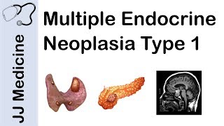 Multiple Endocrine Neoplasia Type 1 MEN1  Signs and Symptoms Diagnosis and Treatment [upl. by Dripps]