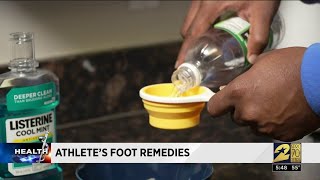 How to help knock out Athletes Foot [upl. by Neelhtak]