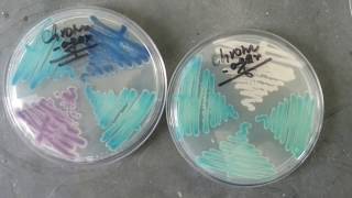 chromagar detection of various Candida spp [upl. by Esyle754]