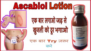 Ascabiol Lotion  Full Review  in Hindi [upl. by Sacrod491]