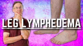 Top 3 Exercises for Leg Lymphedema Swelling or Edema [upl. by Ayotl]