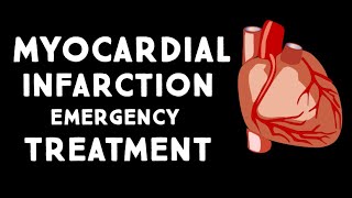 Myocardial Infarction MIHeart Attack Treatment in Emergency  Step wise STEMI Management USMLE [upl. by Enitsugua]