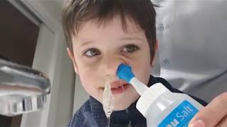 Cómo limpiar la sinusitis a un niño [upl. by Reyotal]