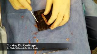 Rib Cartilage Carving  Live Surgical Footage for Rhinoplasty [upl. by Chainey156]