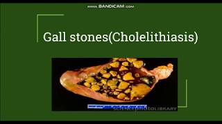 Cholelithiasis  Gallstones Pathogenesis amp Morphology [upl. by Home]