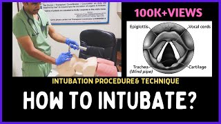 Intubation Extubation 37 [upl. by Hosbein459]