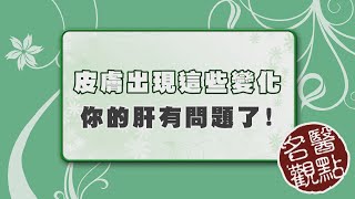 【名醫觀點】皮膚癢代表肝不好？台大教授告訴你 這些皮膚症狀可能肝有問題！ [upl. by Ahsiret]